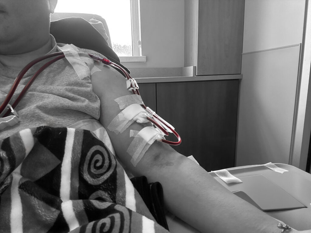 a Hmong patient on hemodialysis